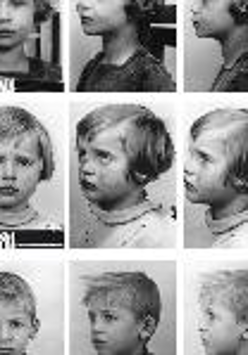 Black and white photo divided into 9 small pictures of sad children faces taken in profile and en face.