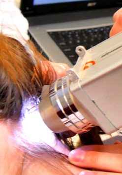 badanie znamion dermatoskopem