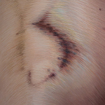 Fragment obrazu