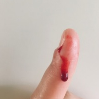 Zdjęcie palca, na nim kropla krwi.