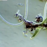 Zdjęcie mikroskopowe przedstawiające nieregularne kształty na szarym tle.