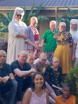 Na zdjęciu albinoskie dzieci z Tanzanii.