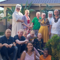 Na zdjęciu albinoskie dzieci z Tanzanii.