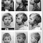 Black and white photo divided into 9 small pictures of sad children faces taken in profile and en face.