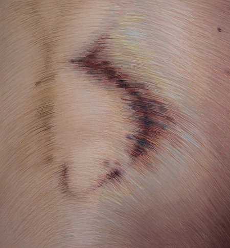 Fragment obrazu